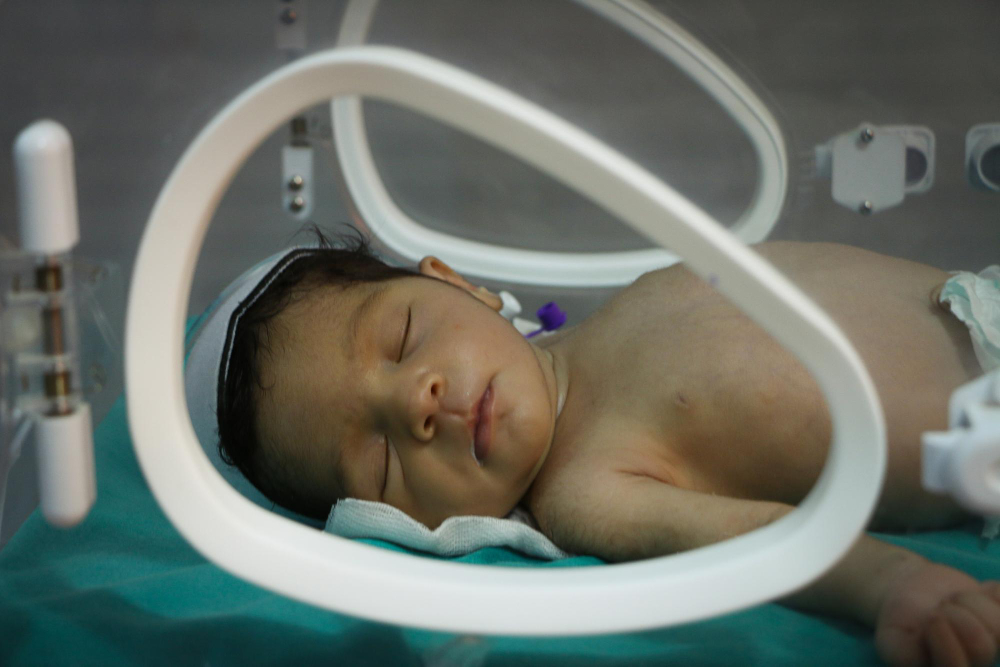 What is Neonatal Jaundice? Understanding Causes, Symptoms, and Treatment